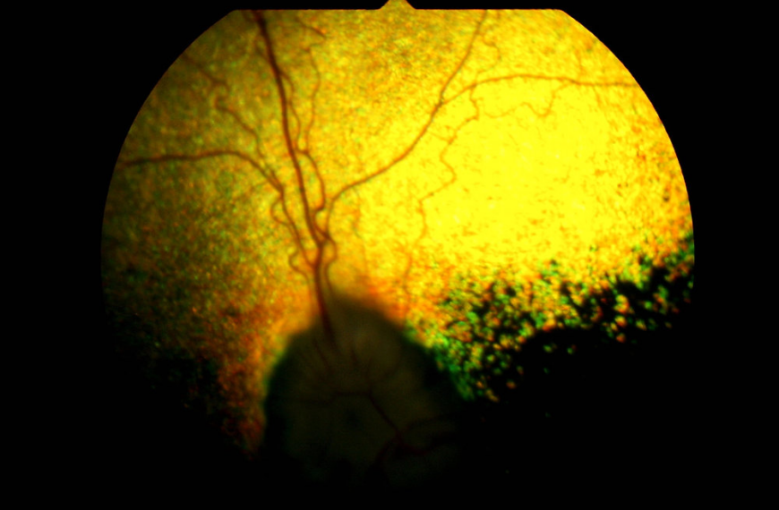 progressive retinal atrophy (PRA)